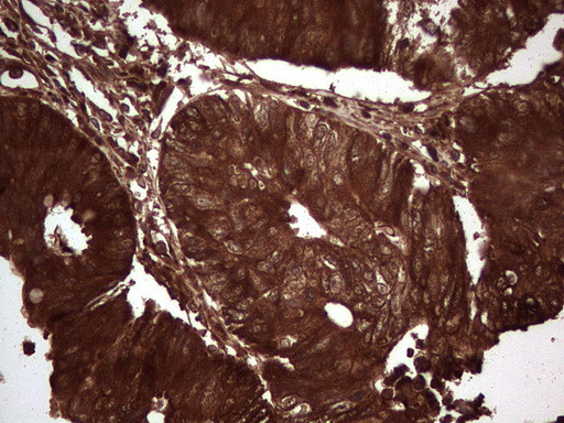 LGALS3 Antibody in Immunohistochemistry (Paraffin) (IHC (P))