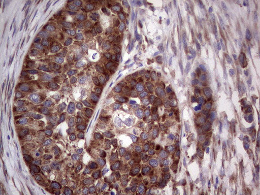 LGALS3 Antibody in Immunohistochemistry (Paraffin) (IHC (P))