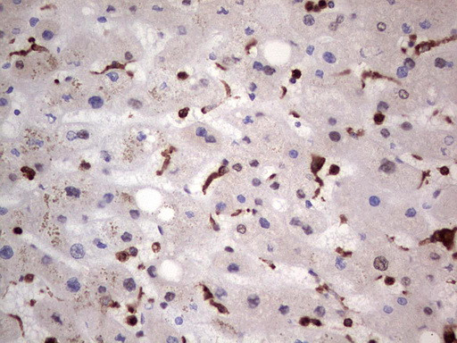 LGALS3 Antibody in Immunohistochemistry (Paraffin) (IHC (P))