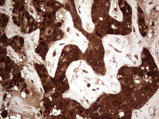 LGALS3 Antibody in Immunohistochemistry (Paraffin) (IHC (P))