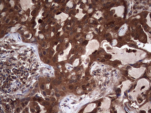 LGALS3 Antibody in Immunohistochemistry (Paraffin) (IHC (P))