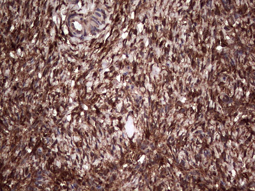 LGALS3 Antibody in Immunohistochemistry (Paraffin) (IHC (P))