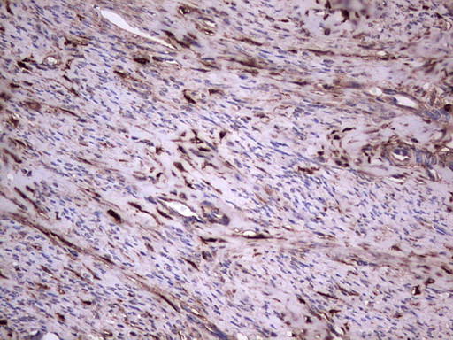 LGALS3 Antibody in Immunohistochemistry (Paraffin) (IHC (P))