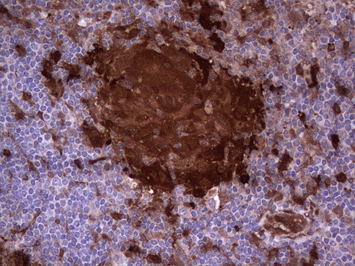 LGALS3 Antibody in Immunohistochemistry (Paraffin) (IHC (P))