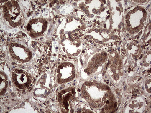 LGALS3 Antibody in Immunohistochemistry (Paraffin) (IHC (P))