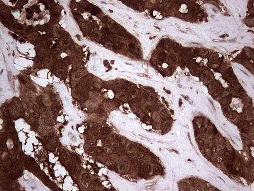 LGALS3 Antibody in Immunohistochemistry (Paraffin) (IHC (P))