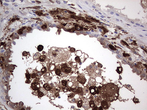 LGALS3 Antibody in Immunohistochemistry (Paraffin) (IHC (P))