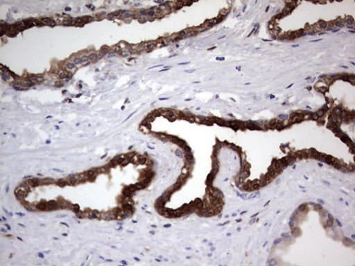 LGALS3 Antibody in Immunohistochemistry (Paraffin) (IHC (P))