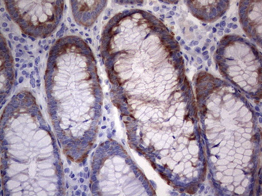 LGALS3 Antibody in Immunohistochemistry (Paraffin) (IHC (P))