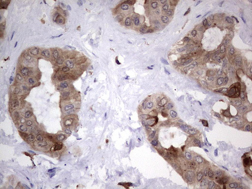 LGALS3 Antibody in Immunohistochemistry (Paraffin) (IHC (P))