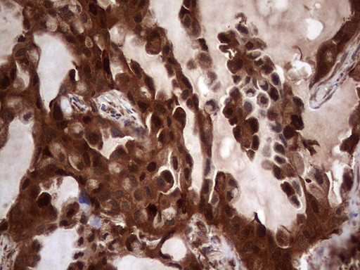 LGALS3 Antibody in Immunohistochemistry (Paraffin) (IHC (P))