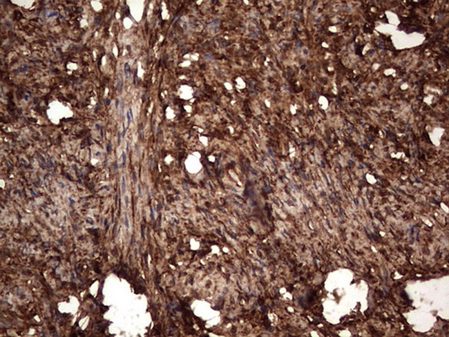 LGALS3 Antibody in Immunohistochemistry (Paraffin) (IHC (P))