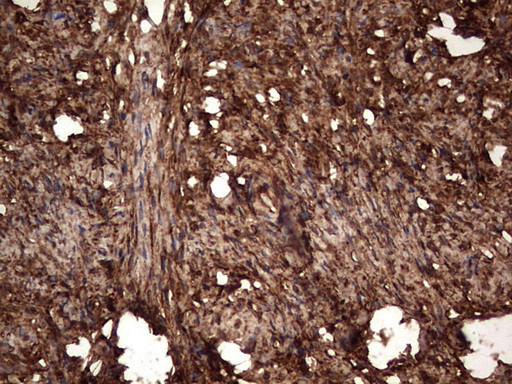 LGALS3 Antibody in Immunohistochemistry (Paraffin) (IHC (P))