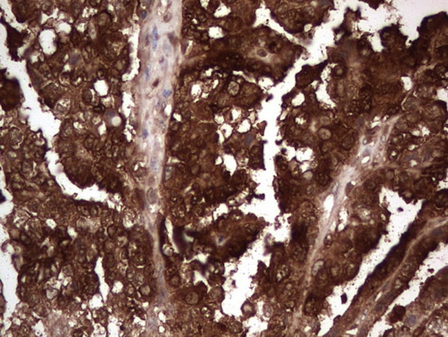 LGALS3 Antibody in Immunohistochemistry (Paraffin) (IHC (P))