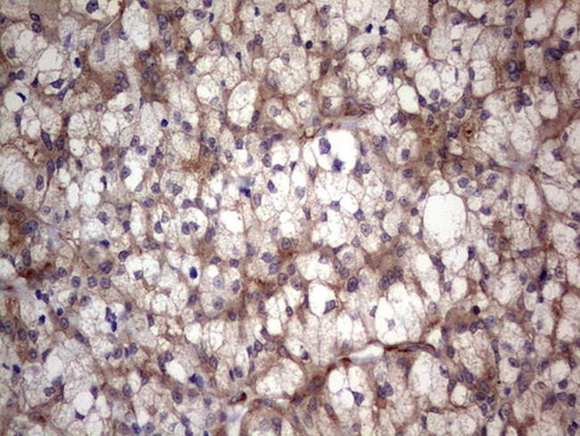 LGALS3 Antibody in Immunohistochemistry (Paraffin) (IHC (P))