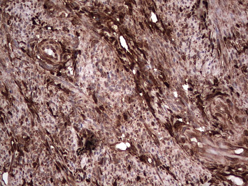 LGALS3 Antibody in Immunohistochemistry (Paraffin) (IHC (P))