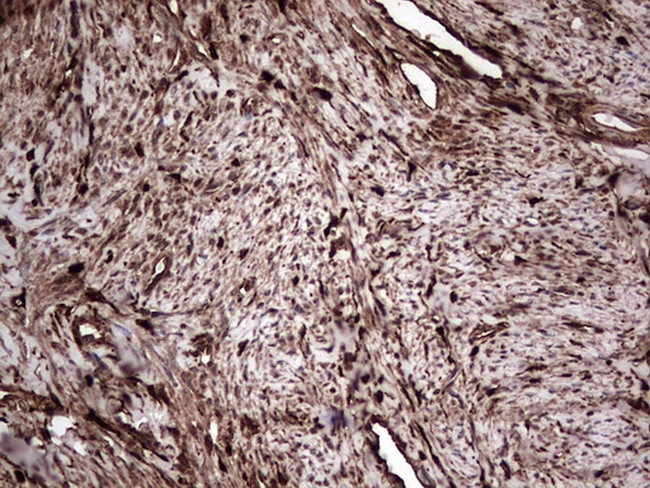 LGALS3 Antibody in Immunohistochemistry (Paraffin) (IHC (P))