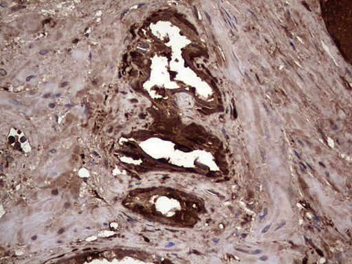 LGALS3 Antibody in Immunohistochemistry (Paraffin) (IHC (P))