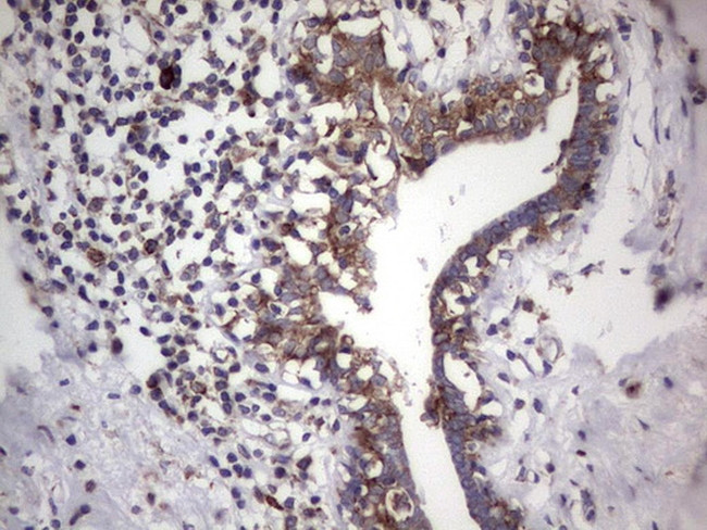 LGALS3 Antibody in Immunohistochemistry (Paraffin) (IHC (P))