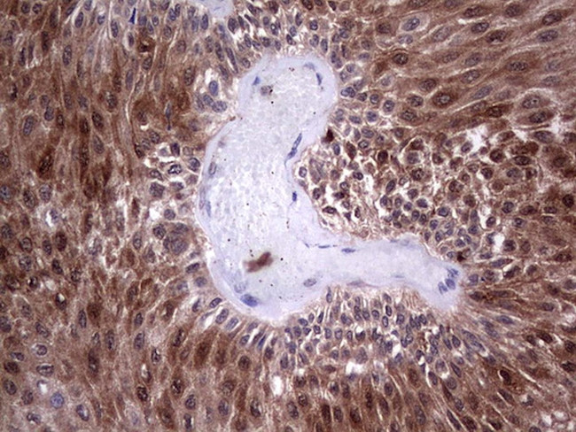 LGALS3 Antibody in Immunohistochemistry (Paraffin) (IHC (P))