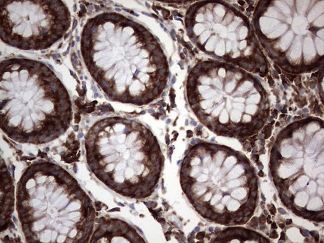 LGALS3 Antibody in Immunohistochemistry (Paraffin) (IHC (P))