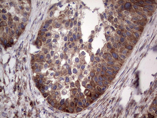 LGALS3 Antibody in Immunohistochemistry (Paraffin) (IHC (P))