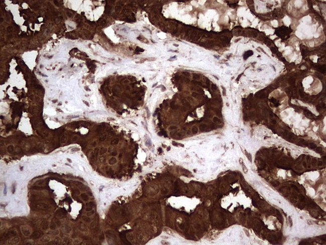 LGALS3 Antibody in Immunohistochemistry (Paraffin) (IHC (P))