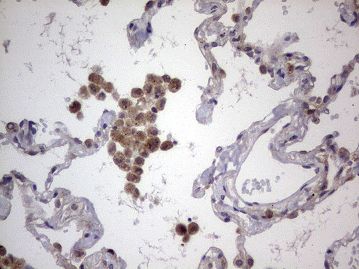 LGALS3 Antibody in Immunohistochemistry (Paraffin) (IHC (P))