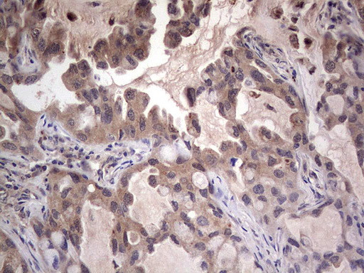 LGALS3 Antibody in Immunohistochemistry (Paraffin) (IHC (P))