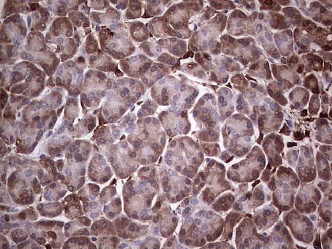 LGALS3 Antibody in Immunohistochemistry (Paraffin) (IHC (P))