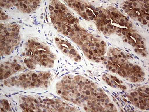 LGALS3 Antibody in Immunohistochemistry (Paraffin) (IHC (P))