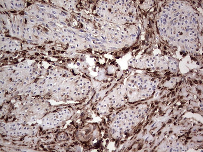 LGALS3 Antibody in Immunohistochemistry (Paraffin) (IHC (P))