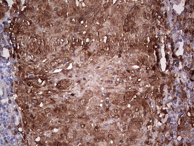 LGALS3 Antibody in Immunohistochemistry (Paraffin) (IHC (P))