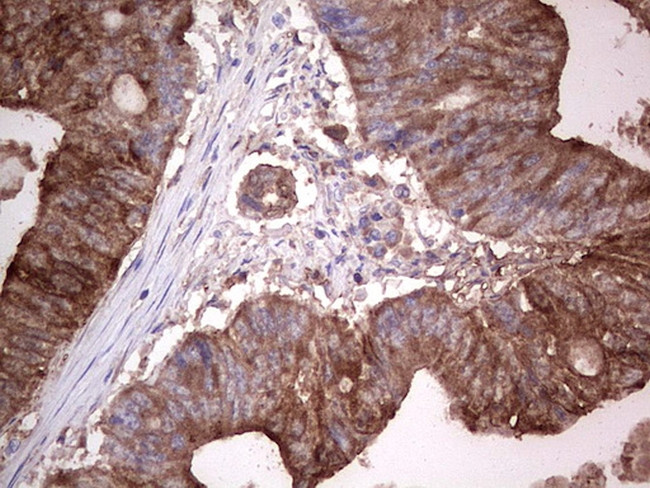 LGALS3 Antibody in Immunohistochemistry (Paraffin) (IHC (P))