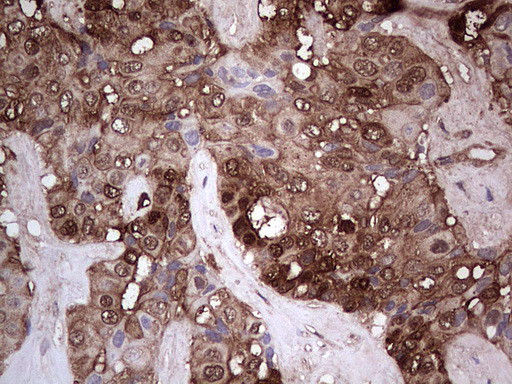 LGALS3 Antibody in Immunohistochemistry (Paraffin) (IHC (P))