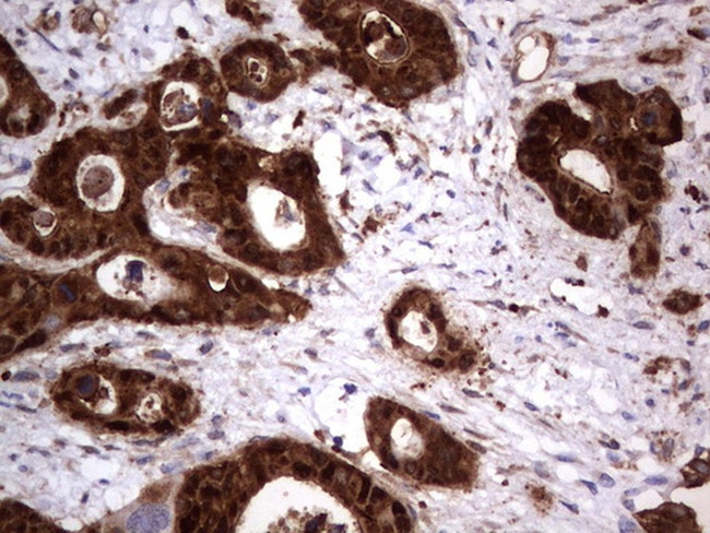 LGALS3 Antibody in Immunohistochemistry (Paraffin) (IHC (P))