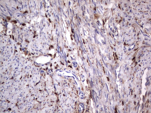 LGALS3 Antibody in Immunohistochemistry (Paraffin) (IHC (P))