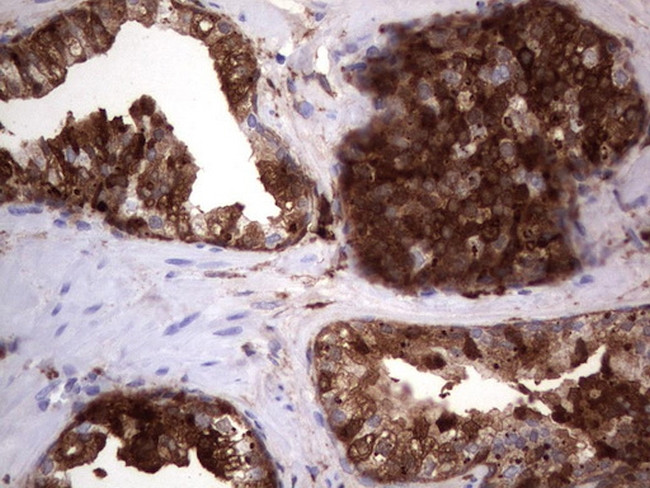 LGALS3 Antibody in Immunohistochemistry (Paraffin) (IHC (P))