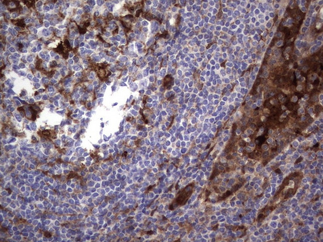 LGALS3 Antibody in Immunohistochemistry (Paraffin) (IHC (P))