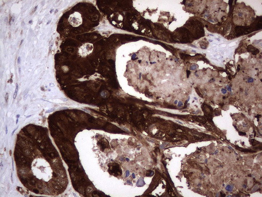 LGALS3 Antibody in Immunohistochemistry (Paraffin) (IHC (P))