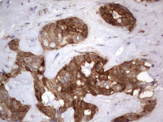 LGALS3 Antibody in Immunohistochemistry (Paraffin) (IHC (P))