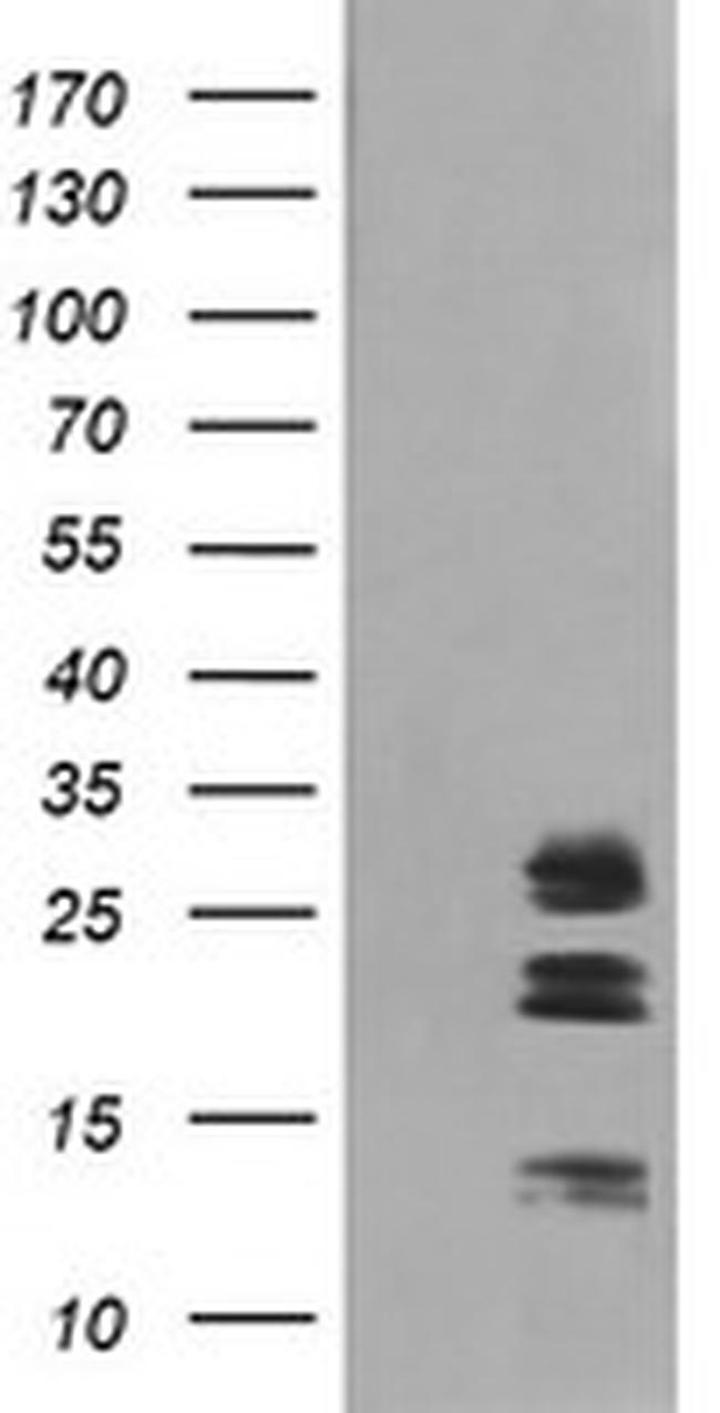 LGALS3 Antibody in Western Blot (WB)