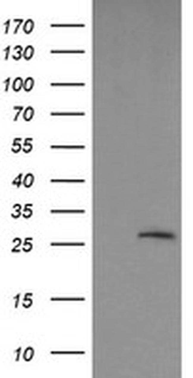 LGALS3 Antibody in Western Blot (WB)