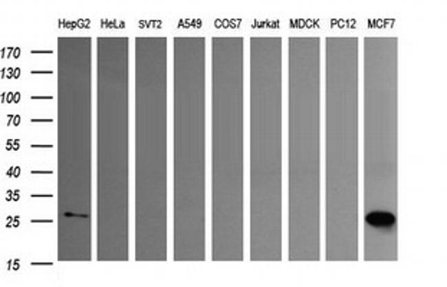 LGALS3 Antibody in Western Blot (WB)