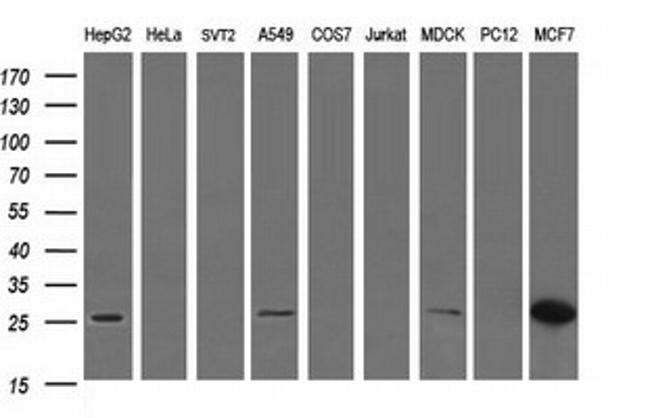 LGALS3 Antibody in Western Blot (WB)