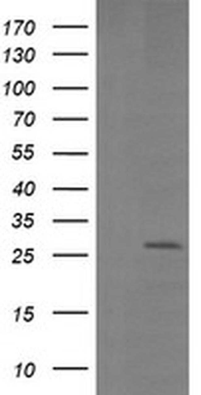 LGALS3 Antibody in Western Blot (WB)