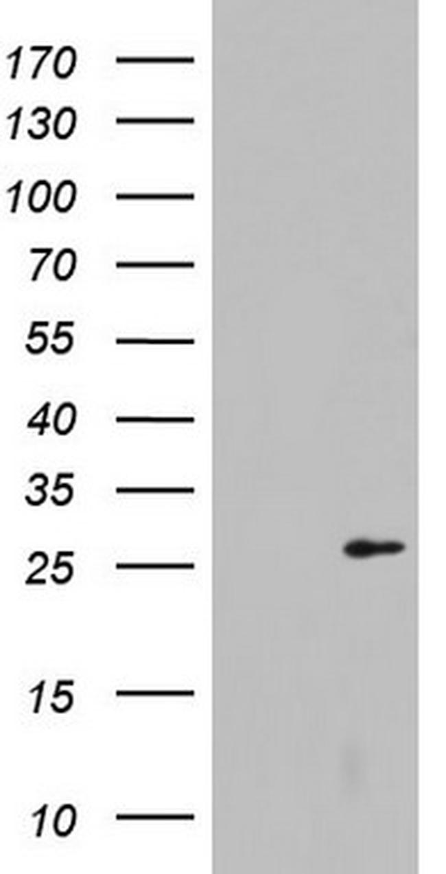 LGALS3 Antibody in Western Blot (WB)