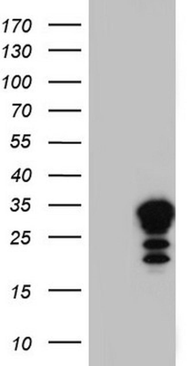 LGALS3 Antibody in Western Blot (WB)