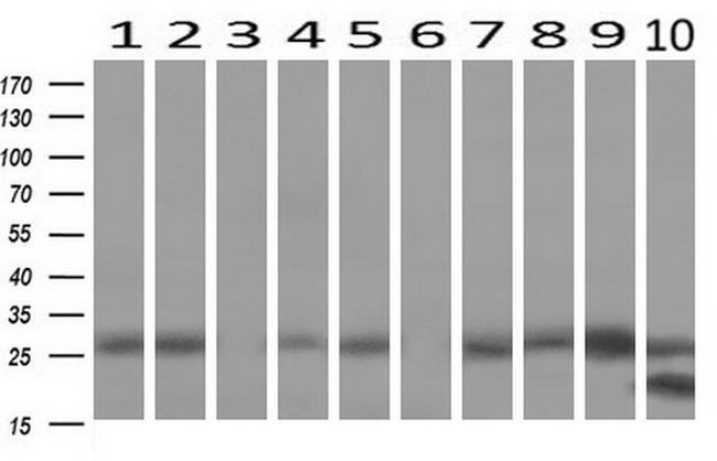 LGALS3 Antibody in Western Blot (WB)