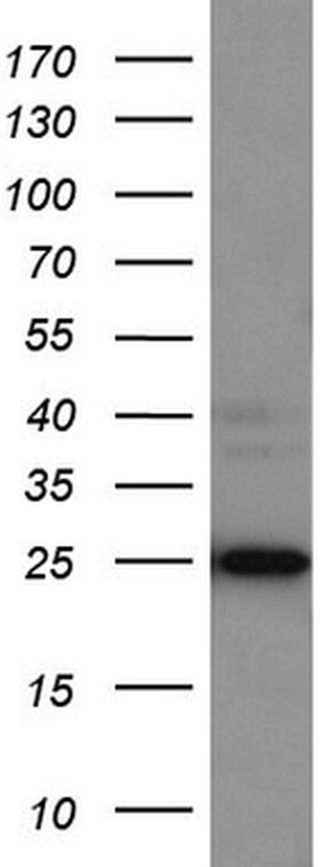 LGALS3 Antibody in Western Blot (WB)